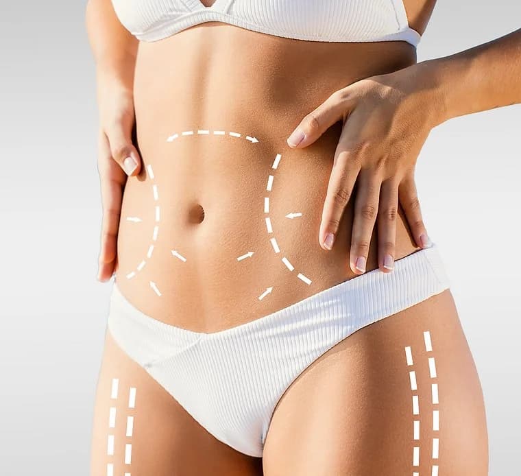 Artemis Single Session T Shape Body
