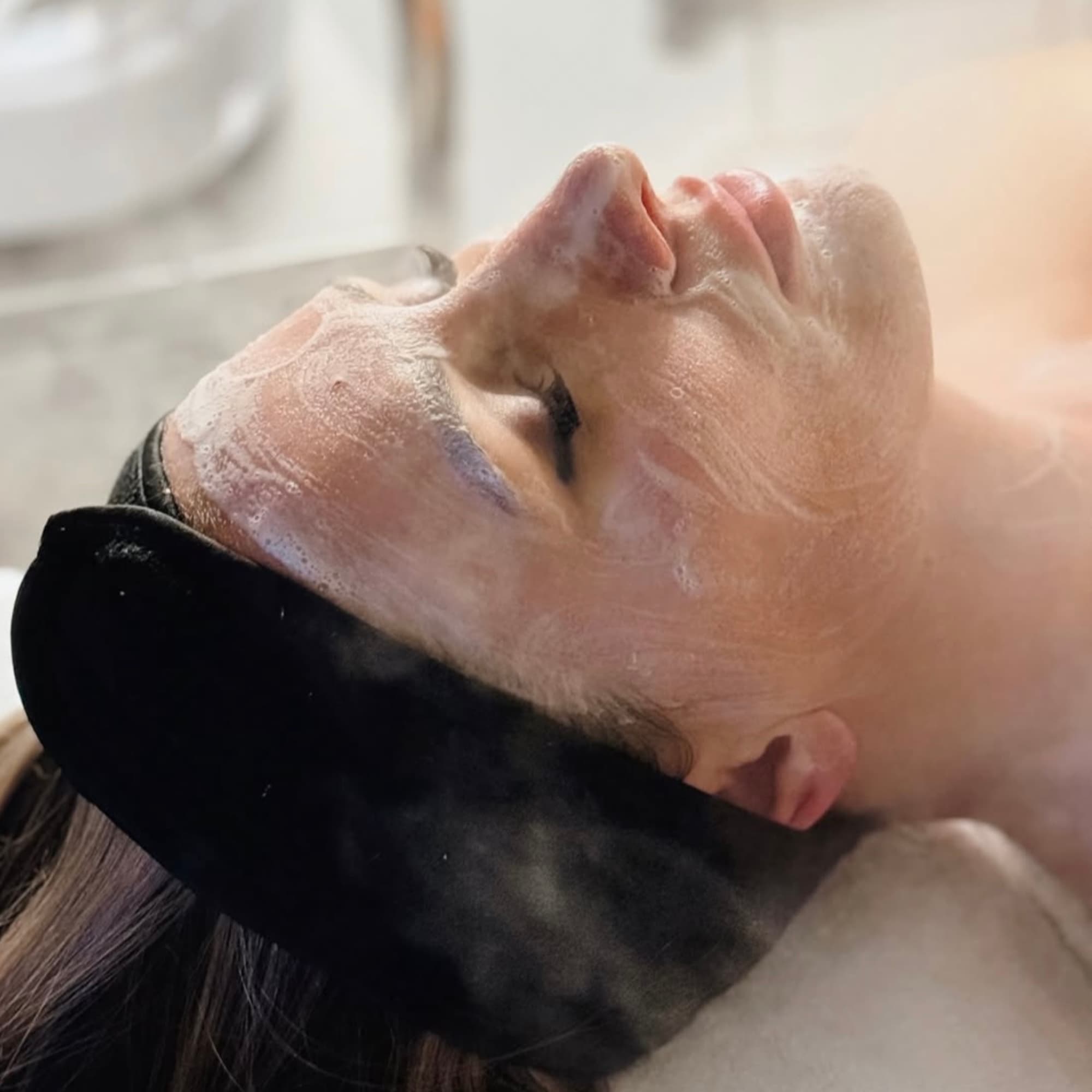 Factor Five Chemical Peel (1 Session)
